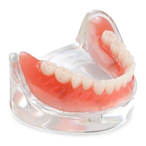 ANNWAH Dental Overdenture Inferior Model - Locator Denture Model with 4 Implants Implant Locator Model Teaching Study Teeth Model