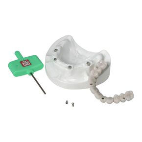 Dental Typodont Implant Restoration Model Upper Jaw Type All-on-4 Overdenture Model Removable M6023