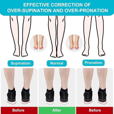 2 Pairs 3 Layers Medial & Lateral Heel Wedge Silicone Insoles - Corrective Adhesive Shoe Inserts for Foot Alignment, Knock Knee Pain, Bow Legs, Osteoarthritis for Men and Women(Large) in Saudi Arabia