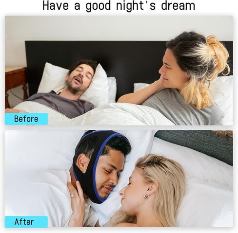 Anti Snoring Chin Strap,Anti Snoring Devices for Cpap Users,Adjustable and Breathable Chin Strap Effective Reduce Snoring for Men and Women (Light Blue) in Saudi Arabia