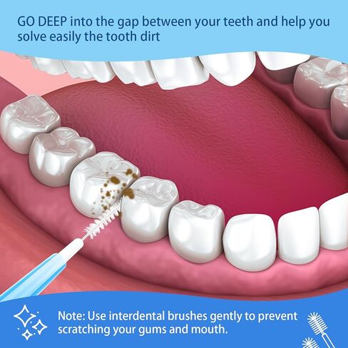 100 قطعة من فرش آنهوا المتدرجة بين الأسنان، فرشاة تنظيف الأسنان بالدفع والسحب مع صندوق تخزين (برتقالي، أصفر، وردي، أخضر، أزرق) in Kuwait