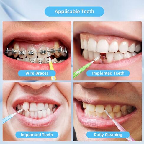 100 قطعة من فرش آنهوا المتدرجة بين الأسنان، فرشاة تنظيف الأسنان بالدفع والسحب مع صندوق تخزين (برتقالي، أصفر، وردي، أخضر، أزرق) in Kuwait