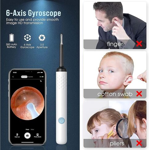 Ear Wax Removal, Earwax Removal Kit with 7 Pcs Ear Set, Ear Cleaning Kit with 4 Ear Pick, Ear Cleaner Otoscope with Light, Ear Camera for iPhone, iPad, Android Phones in Saudi Arabia