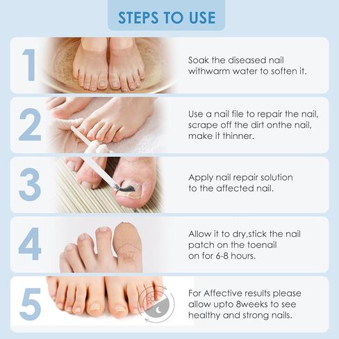 تجديد أظافر فطريات أظافر القدم من AUSLKA، إصلاح أظافر أصابع القدم للأظافر التالفة التي تغير لونها، سريع وسهل (32 رقعة + 1 فلوريدا/أونصة) in Kuwait