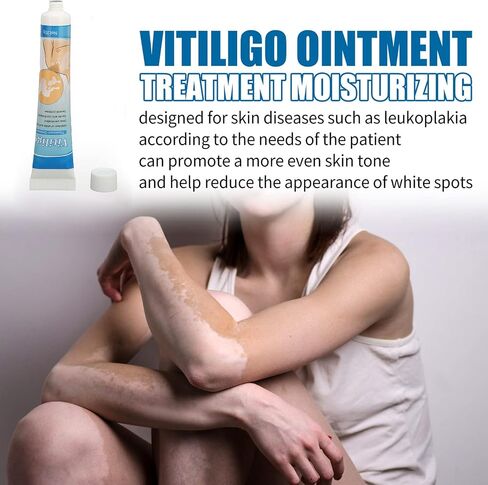 Vitiligo Cream Safe herbal extract Ointment for of vitiligo Natural professional skin pigmentation for individual care in Saudi Arabia
