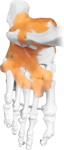 Vision Scientific VAS215-DC Medical Grade, Full Size Skeleton W Hand Painted Muscles & Ligaments | Thick Zip Dust Cover | Skeleton Wired for Natural Movement | Mounted on Roller Stand W Manual in Saudi Arabia