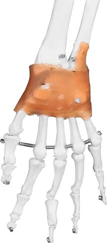 Vision Scientific VAS215-DC Medical Grade, Full Size Skeleton W Hand Painted Muscles & Ligaments | Thick Zip Dust Cover | Skeleton Wired for Natural Movement | Mounted on Roller Stand W Manual in Saudi Arabia