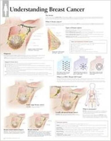 Understanding Breast Cancer Wall Chart in Saudi Arabia