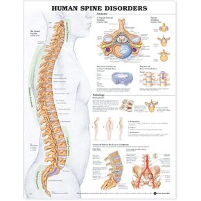 Human Spine Disorders Anatomical Chart