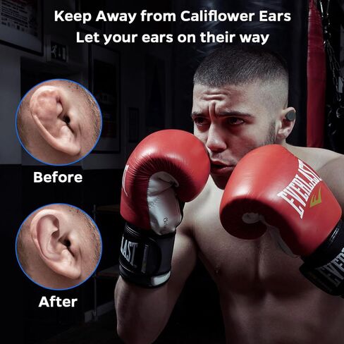 Cauliflower Ear Magnet - Effective Magnets Compression Kit - Prevention & Treatment of Hematomas & Keloid in BJJ, Wrestling, MMA, Grappling, Boxing, Muay Thai, Rugby (Small, 1 Pair) in Saudi Arabia