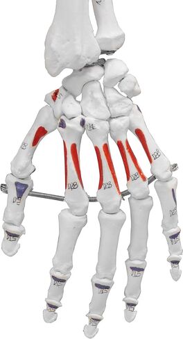 Vision Scientific VAS215-DC Medical Grade, Full Size Skeleton W Hand Painted Muscles & Ligaments | Thick Zip Dust Cover | Skeleton Wired for Natural Movement | Mounted on Roller Stand W Manual in Saudi Arabia