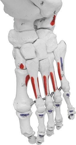 Vision Scientific VAS215-DC Medical Grade, Full Size Skeleton W Hand Painted Muscles & Ligaments | Thick Zip Dust Cover | Skeleton Wired for Natural Movement | Mounted on Roller Stand W Manual in Saudi Arabia