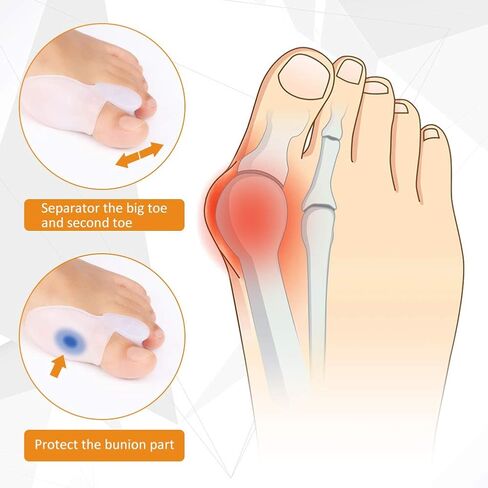 مجموعة جل لحماية ورم إصبع القدم الكبير للرجال والنساء، مصحح ورم إصبع القدم الكبير لعلاج إصبع القدم المطرقة، وأصابع القدم المتداخلة وأصابع القدم الملتوية، للاستخدام ليلاً ونهارًا للجري والنوم in Kuwait
