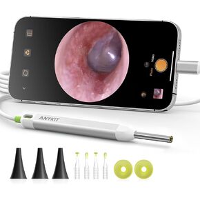 Anykit 3.9 mm Visual Digital Otoscope with 6 LED Lights and Earwax Removal Tool for Adults & Children, Compatible with iPhone & Android
