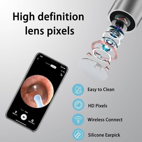 Ear Wax Removal with Camera - Smart Ear Canal Explorer, HD Imaging for Effective Cleaning in Saudi Arabia