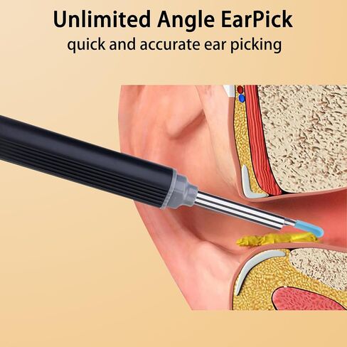 Ear Wax Removal with Camera - Smart Ear Canal Explorer, HD Imaging for Effective Cleaning in Saudi Arabia