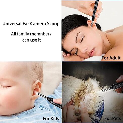 Ear Wax Removal with Camera - Smart Ear Canal Explorer, HD Imaging for Effective Cleaning in Saudi Arabia
