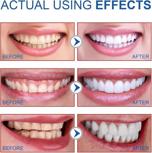 Super Probiotic Sp-6 Toothpaste, Sp-6 Ultra Whitening Toothpaste, Sp 6 Toothpaste,Sp-6 Toothpaste,Fresh Breath 9.8 oz in Kuwait