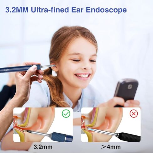Ear Wax Removal Tool with Camera:Bebird Note 5 Ear Cleaner with Otoscope and Light,Visual Earwax Cleaning Kit 3 in 1 Ear Scope WiFi Earwax Remover,Multi Earwax Cleaning Replacement Tips in Kuwait