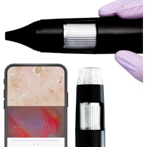 Digital Otoscope and Dermascope in Single Device (OTO-Dermascope) for Clinical Examination and Saving Pictures and Videos