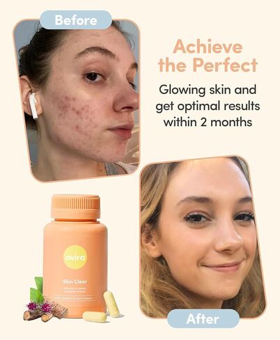 Skin Clear with ZINCBRIGHT - 60 Capsules for Clear and Glowing Skin | Rosacea & Hormonal Acne Treatment | Support Collagen Production | Acne Supplements for Women & Men in Saudi Arabia