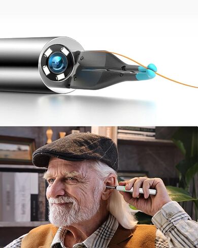 منظف ​​الأذن BEBIRD Note 5: كاميرا أذن FHD مع ملاقط متعددة الاتجاهات، منظار الأذن الذي يدعم تقنية IoT يدعم مقاطع الفيديو عن بعد، غطاء تشغيل/إيقاف مغناطيسي، قاعدة تخزين لنظافة الأذن، 12 قطعة بديلة، أبيض in Kuwait