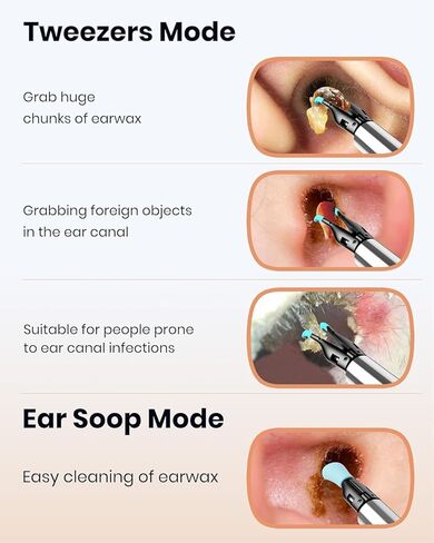 منظف ​​الأذن BEBIRD Note 5: كاميرا أذن FHD مع ملاقط متعددة الاتجاهات، منظار الأذن الذي يدعم تقنية IoT يدعم مقاطع الفيديو عن بعد، غطاء تشغيل/إيقاف مغناطيسي، قاعدة تخزين لنظافة الأذن، 12 قطعة بديلة، أبيض in Kuwait