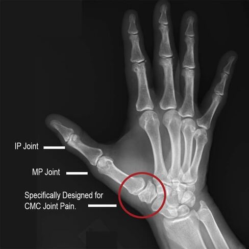 Comfort Cool Thumb CMC Restriction Splint. Patented Thumb Brace Provides Support and Compression. Helps with Arthritis, Tendinitis, Surgery, Dislocations, Sprains, Repetitive Use. in Saudi Arabia
