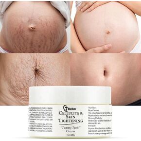 Stretch Marks and Scars Removal Cream for Pregnancy - Scars Repair, Abdominal Firming, and Gentle Stretch Marks Eradication Skincare Body in Kuwait