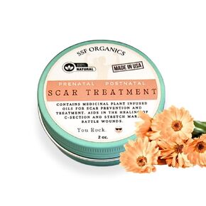 SSF Organics Scar Treatment for Stretch Marks, C-Section Recovery Must Haves - Deeply Moisturize with Calendula, Castor, Shea - Advanced Scar Treatment for Mama Related Wounds