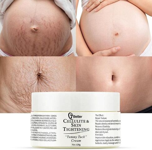 Stretch Marks and Scars Removal Cream for Pregnancy - Scars Repair, Abdominal Firming, and Gentle Stretch Marks Eradication Skincare Body in Kuwait