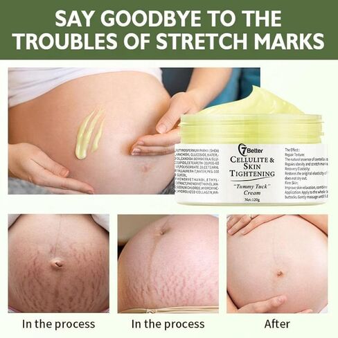 Stretch Marks and Scars Removal Cream for Pregnancy - Scars Repair, Abdominal Firming, and Gentle Stretch Marks Eradication Skincare Body in Kuwait