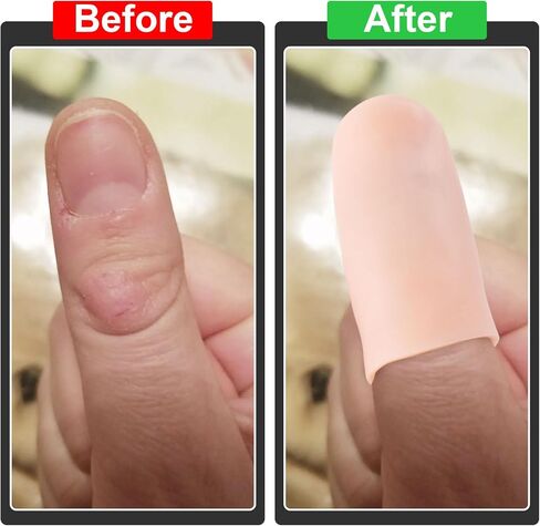 10pcs Gel Finger Cots, Silicone Finger Covers, Thumb Protector Finger Support Protector Caps Gloves in Saudi Arabia