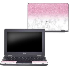 MightySkins Skin Compatible with Dell Chromebook 11" 3189 - Marble Glitz | Protective, Durable, and Unique Vinyl Decal wrap Cover | Easy to Apply, Remove, and Change Styles | Made in The USA