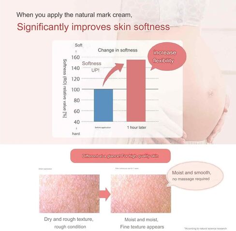 Mama & Kids Natural Cream/Stretch Mark Cream 150g japanese in Saudi Arabia