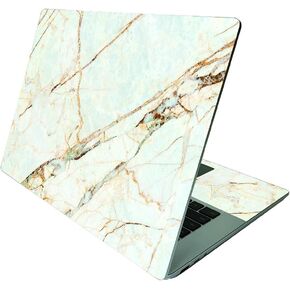 MightySkins Glossy Glitter Skin Compatible with Microsoft Surface Laptop 4 15" - Pretty Pineapple | Protective, Durable High-Gloss Glitter Finish | Easy to Apply and Change Styles | Made in The USA