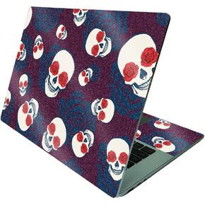 MightySkins Glossy Glitter Skin Compatible with Microsoft Surface Laptop 4 15" - Hearts | Protective, Durable High-Gloss Glitter Finish | Easy to Apply, Remove, and Change Styles | Made in The USA