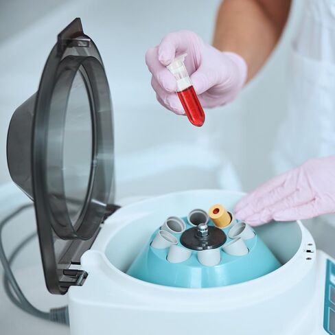 PATIKIL 2ML Plastic Centrifuge Tubes, 500 Pcs Round Bottom Centrifuge Tube with Snap Cap and Graduated Marks for Laboratory Sample, Yellow in Saudi Arabia