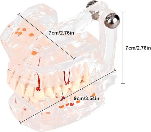 Teeth Model Dental Model Mouth Model Transparent Gingival Tooth Education Model Disease with Nerve for Dental Teaching Study in Saudi Arabia