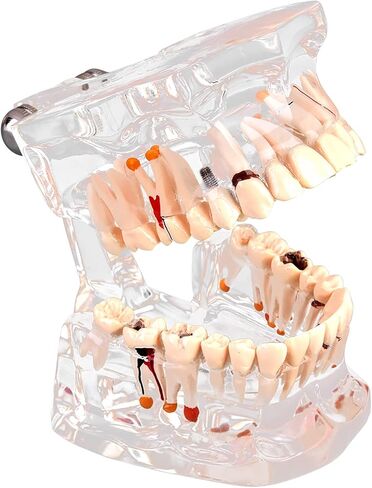 Teeth Model Dental Model Mouth Model Transparent Gingival Tooth Education Model Disease with Nerve for Dental Teaching Study in Saudi Arabia
