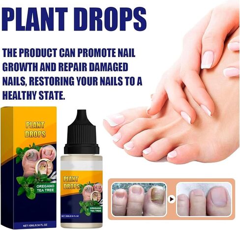 Plant Drops,Oregano Tea Tree Drops,Tea Tree and Oregano Oil for Nails Care,Plant Drops - Plant Drops for Nails Care,10 Ml/0.34 Fl.oz (2pcs) in Saudi Arabia