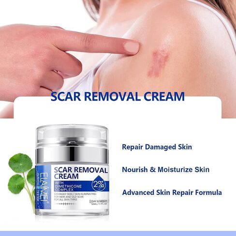 Scar Removal Cream, Scar Repair Cream for Acne Scars, Stretch Marks, Surgical Scars, Burns, Old and New Scars, Natural Formula Scar Cream for Face and Body, Suitable for Most Skin Types in Saudi Arabia