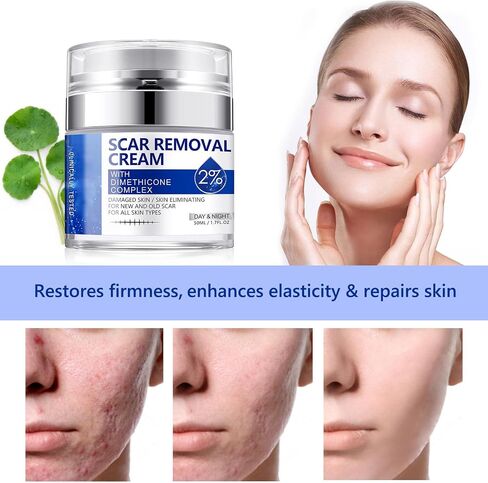 Scar Removal Cream, Scar Repair Cream for Acne Scars, Stretch Marks, Surgical Scars, Burns, Old and New Scars, Natural Formula Scar Cream for Face and Body, Suitable for Most Skin Types in Saudi Arabia
