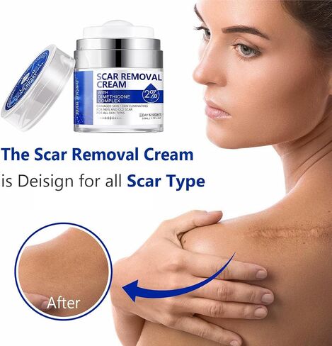 Scar Removal Cream, Scar Repair Cream for Acne Scars, Stretch Marks, Surgical Scars, Burns, Old and New Scars, Natural Formula Scar Cream for Face and Body, Suitable for Most Skin Types in Saudi Arabia