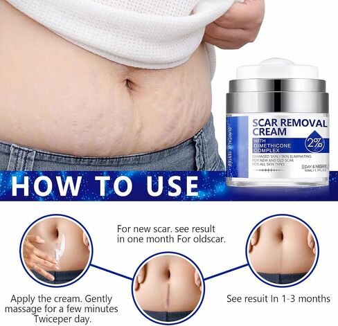 Scar Removal Cream, Scar Repair Cream for Acne Scars, Stretch Marks, Surgical Scars, Burns, Old and New Scars, Natural Formula Scar Cream for Face and Body, Suitable for Most Skin Types in Saudi Arabia