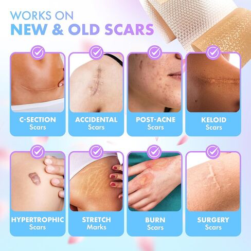Silicone Scar Tape for Comprehensive Scar Care - Scar Treatment for Surgical Scars, C-Section, Keloid Bump Removal - Extra Long Roll for Extended Use - 130 x 1.5 inch in Saudi Arabia