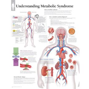 Metabolic Syndrome chart: Wall Chart