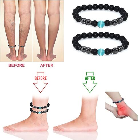 Todenb خلخال سبج أسود مضاد للتورم، قطعتين خلخال سبج أسود تورم، سوار مطرز سبج للرجال/النساء in Kuwait