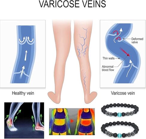 Todenb خلخال سبج أسود مضاد للتورم، قطعتين خلخال سبج أسود تورم، سوار مطرز سبج للرجال/النساء in Kuwait
