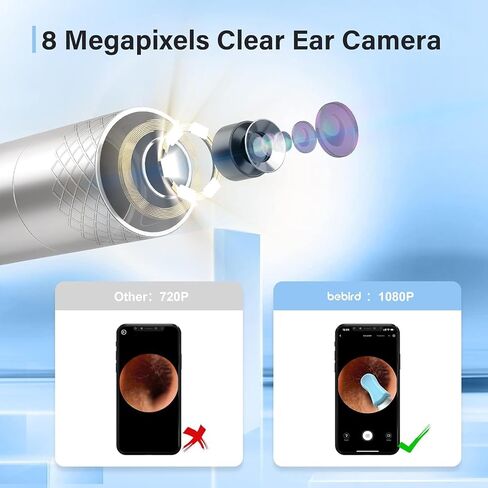 Ear Wax Removal Tool Camera, Ear Wax Removal, Bebird Ear Cleaner with Camera with 1080P Otoscope with Light, Ear Wax Removal Kit with 9 Ear Pick, Ear Camera Compatible for iPhone, iPad, Android Phone in Saudi Arabia